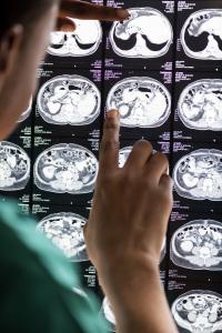 American Association of Neurological Surgeons (AANS)